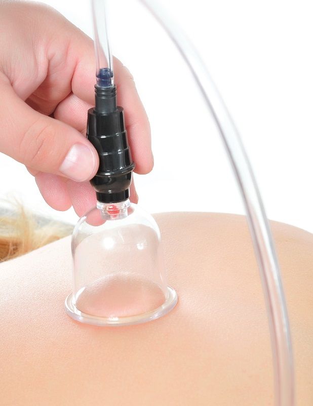 FETISH FANTASY SERIES - 6 PIECE CUPPING SET